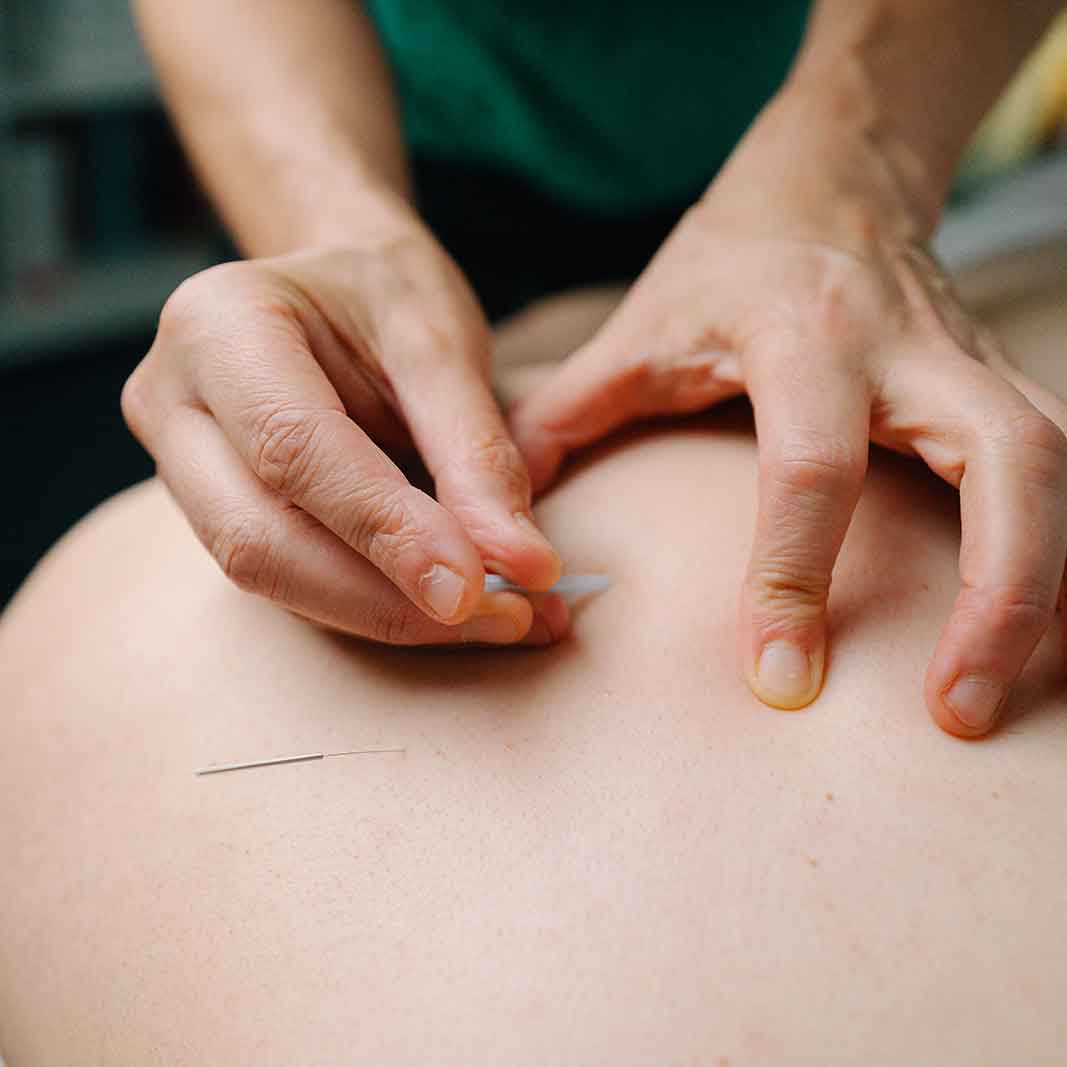 acupuncture-integrative-therapies