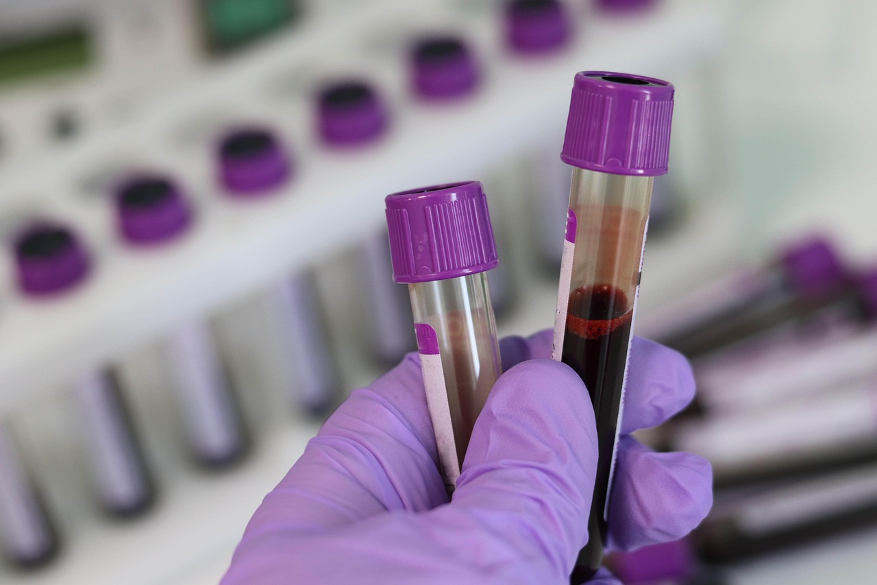 Blood tests for elevated liver enzymes